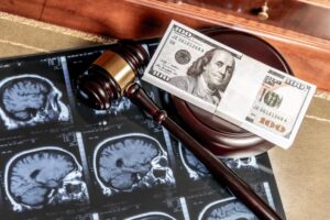 The image featuring brain MRI images, a gavel, and US currency, blending legal and medical concepts. It captures the connection between law, medicine, and financial compensation in a professional context.