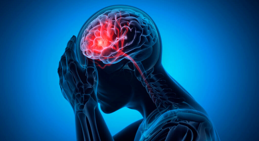 TBI